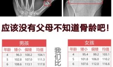 儿童测骨龄大概多少钱都需要测什么（为什么医院不建议测骨龄）
