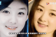 赵丽颖整容呀对比前后（赵丽颖素颜的图片）