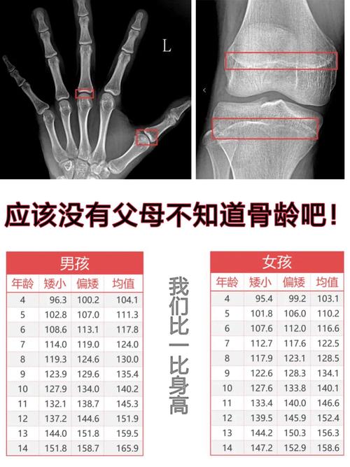 儿童测骨龄大概多少钱都需要测什么(为什么医院不建议测骨龄)