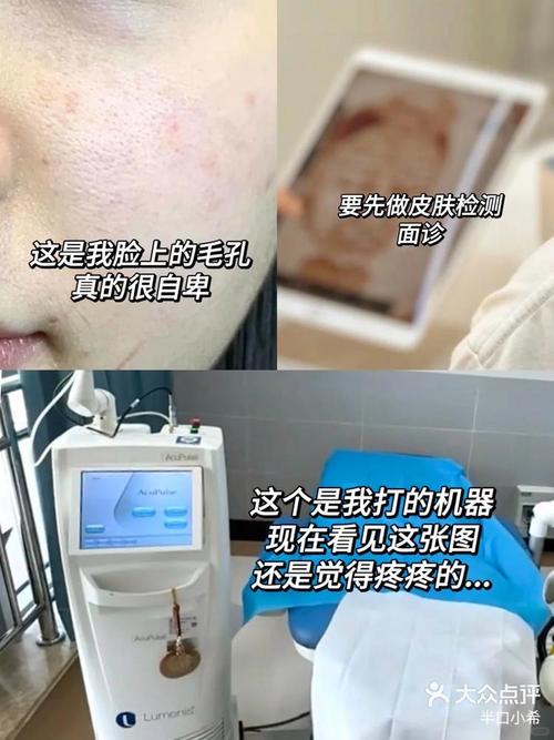 激光治疗毛孔粗大价格(激光治毛孔粗大靠谱吗)