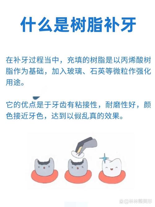纳米树脂补牙多少钱一颗(补一颗牙齿大概多少钱左右)